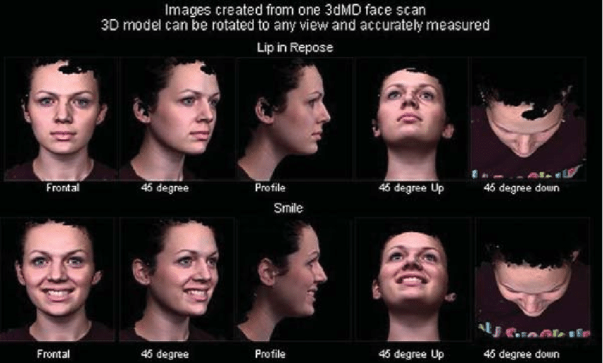 Scan the front of your face in a neutral pose